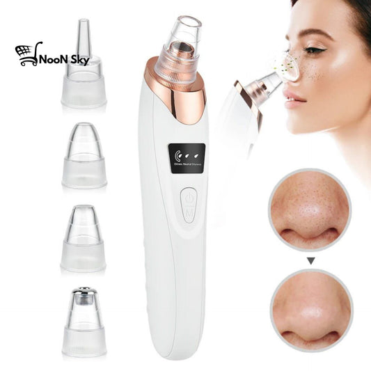 Electric Blackheads Remover